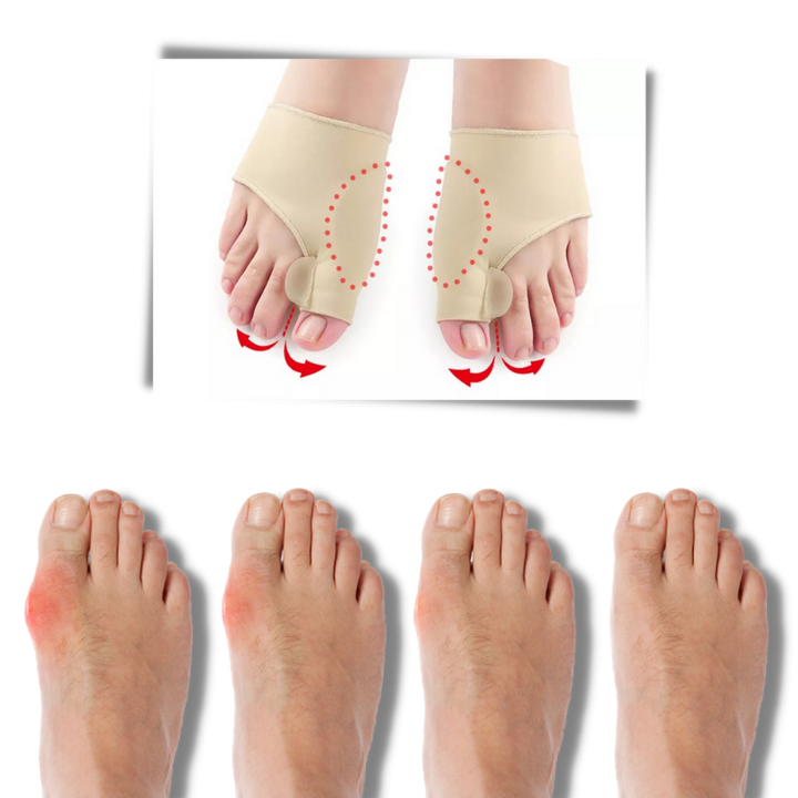 Correcteur d'oignons de pieds en gel - Ozerty