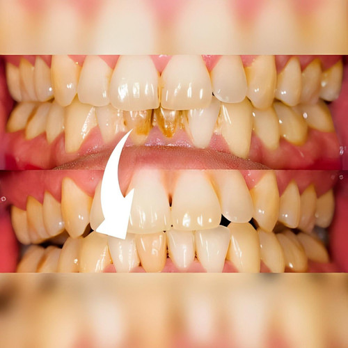 Profesjonalny przenośny skaler dentystyczny, wodoodporny IPX6