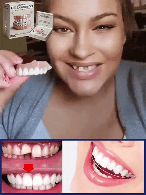 Découvrez le bien-être d'un sourire complet grâce à cette prothèse dentaire amovible et confortable.