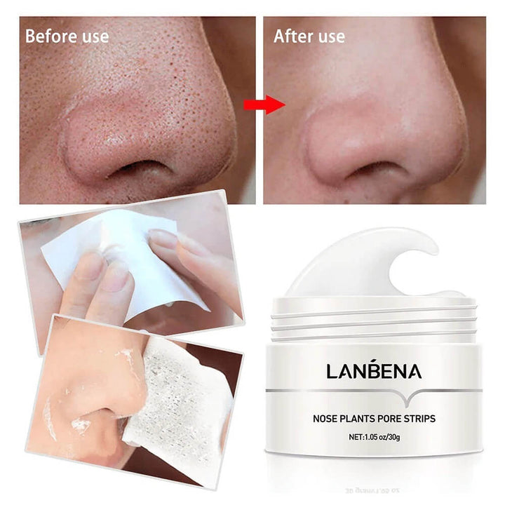 LANBENA™ Masque pour le visage contre les points noirs