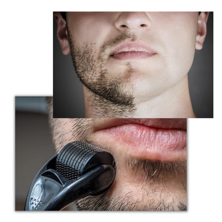 Rouleau dermique pour la croissance des cheveux et de la barbe - Ozerty