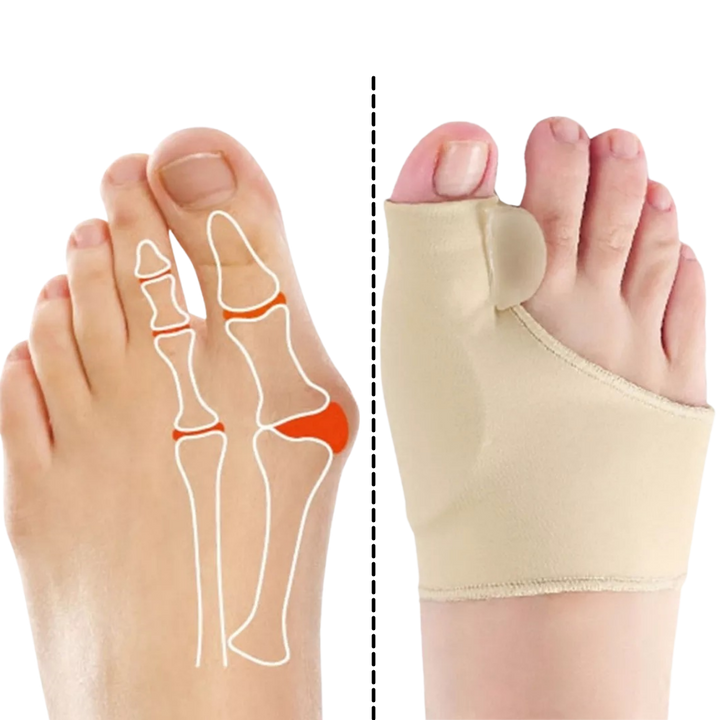 Correcteur d'oignons de pieds en gel - Ozerty