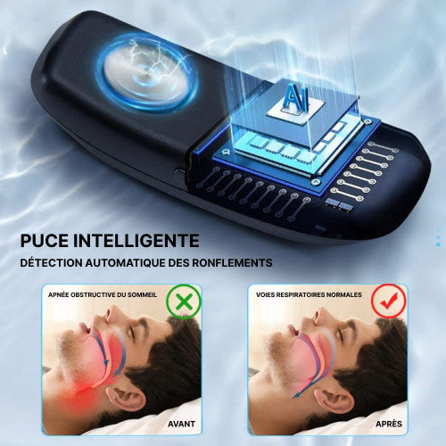 Comfortabel en effectief anti-snurk apparaat