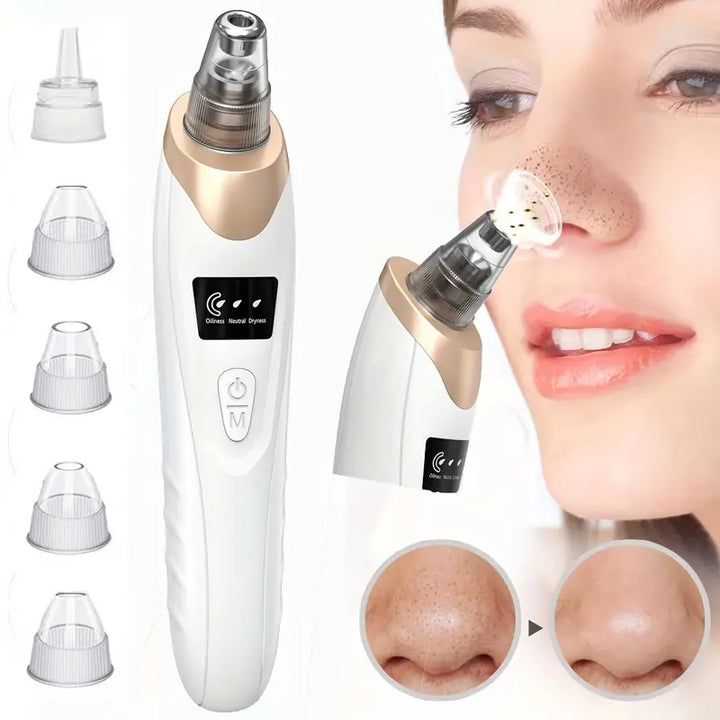 Aspirateur points noirs, nettoyage visage pro.  Élimine impuretés et excès de sébum. Peau éclatante garantie.