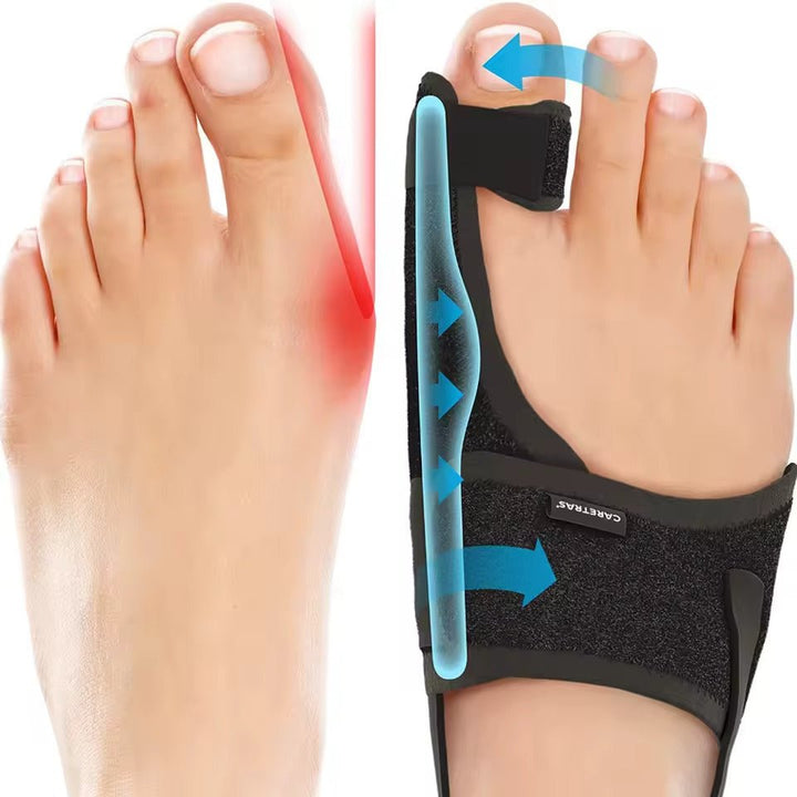 "Attelle de nuit ajustable pour hallux valgus, design ergonomique, assure confort pour un sommeil paisible et sans douleur."