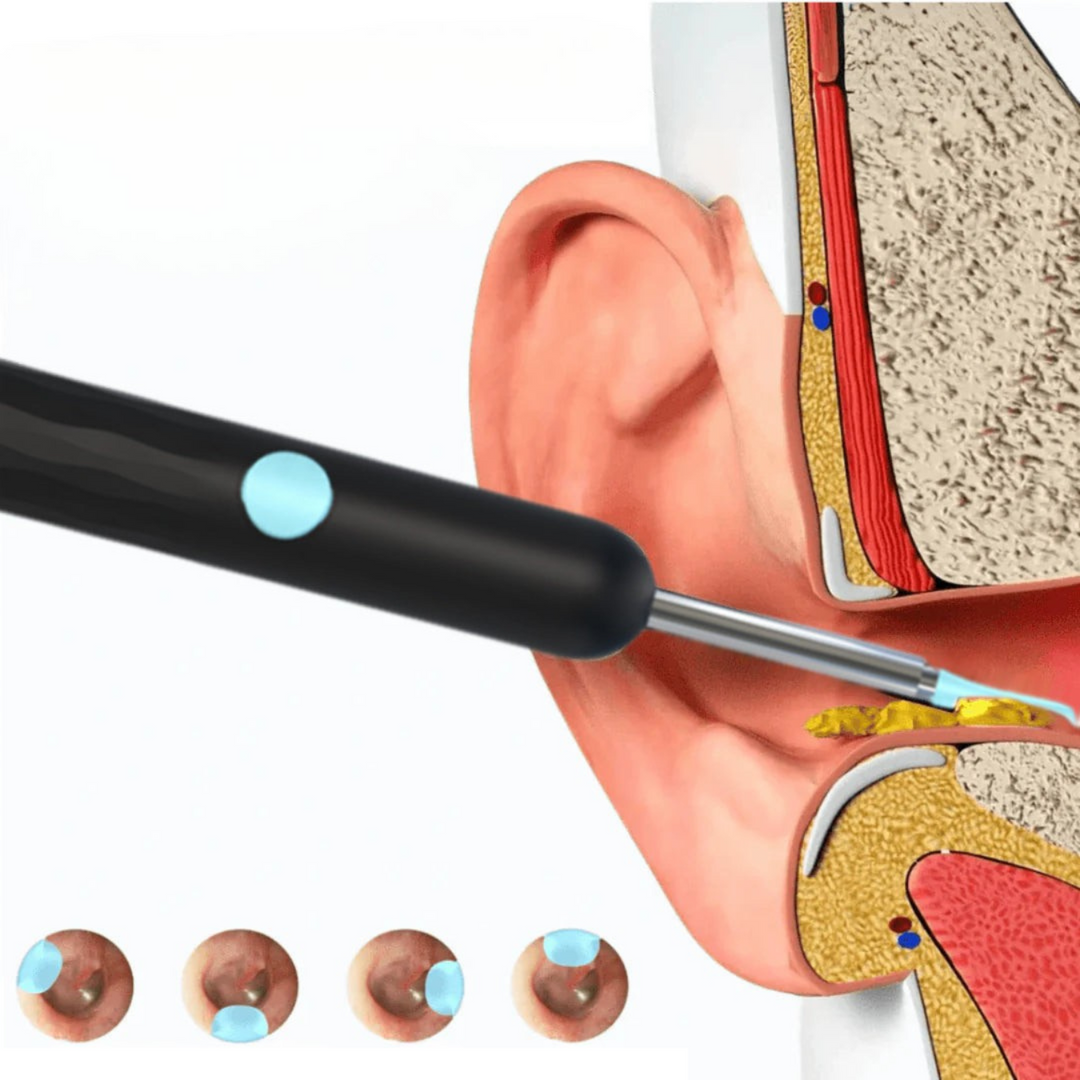 Caméra auriculaire LED HD. Nettoyage oreilles facile et sûr.  Visibilité optimale grâce à 6 LED.