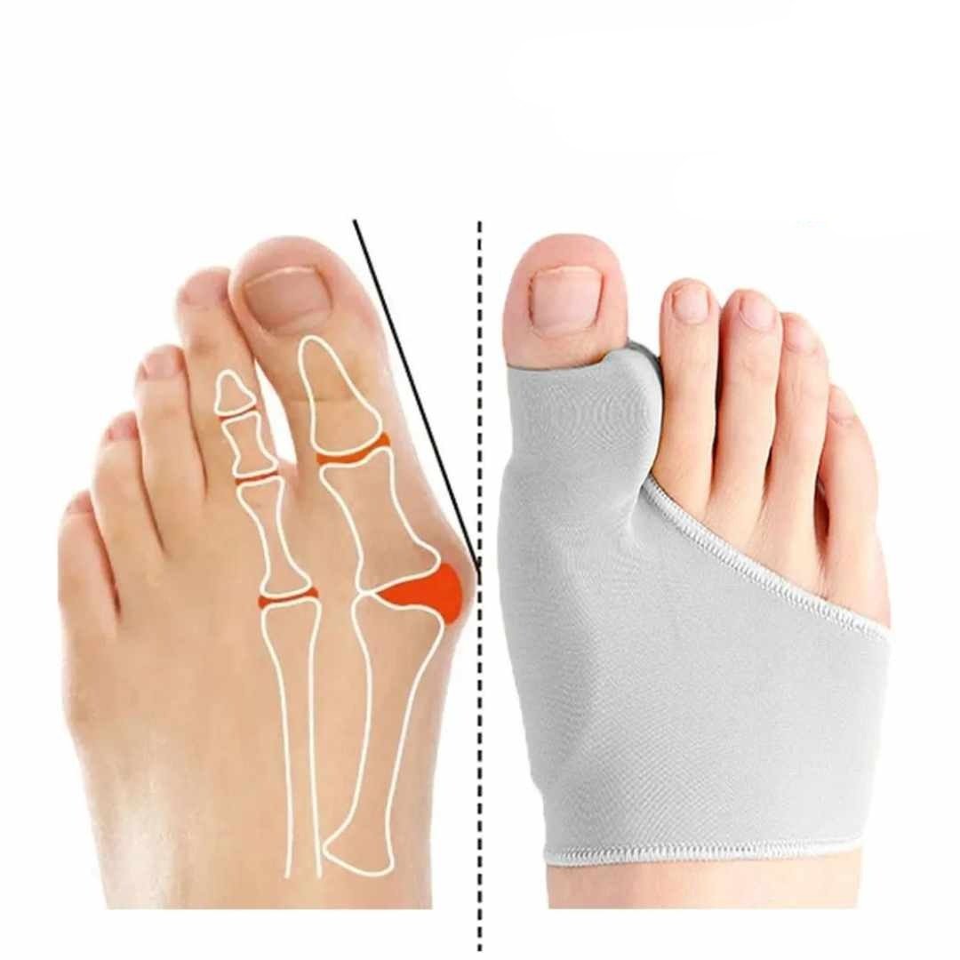"Coffret correcteur orthopédique ergonomique pour Hallux Valgus, soulagement rapide et confort optimal, pieds désalignés"
