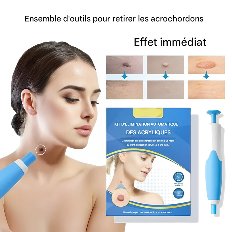 "Kit cryothérapie pour acrochordons, contient 2 appareils, compact et facile à utiliser, pour élimination rapide à domicile."