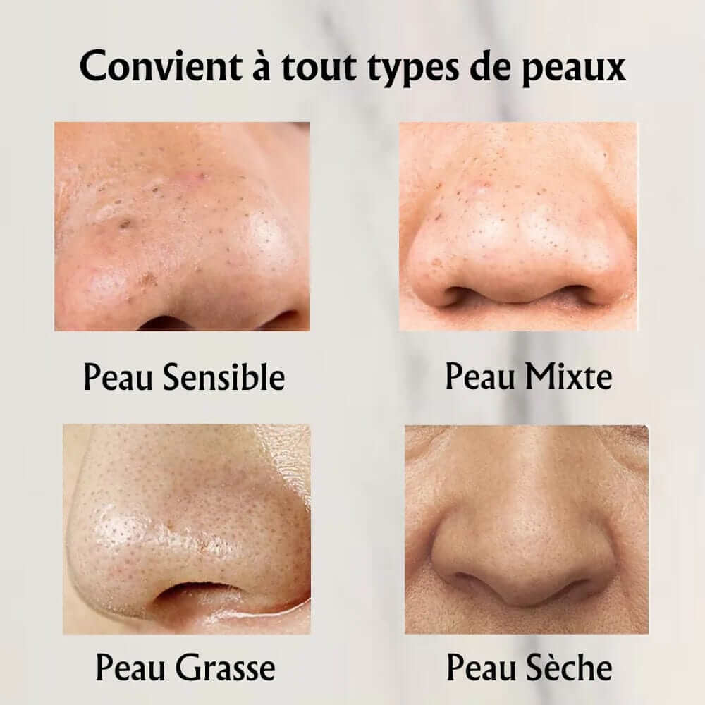 Masque visage purifiant anti-points noirs. Texture douce, nettoyage en profondeur, peau nette et lumineuse.  Soin naturel pou