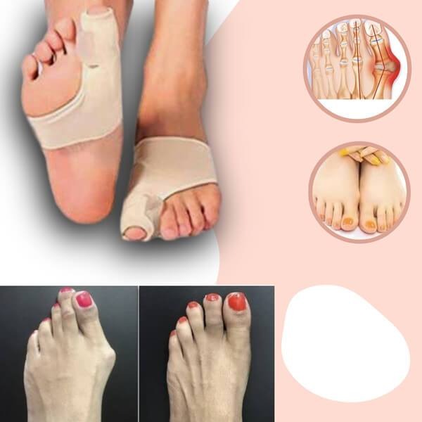 Orthèses hallux valgus en gel polymère. Soulagement douleur pied. Confort et correction douce.